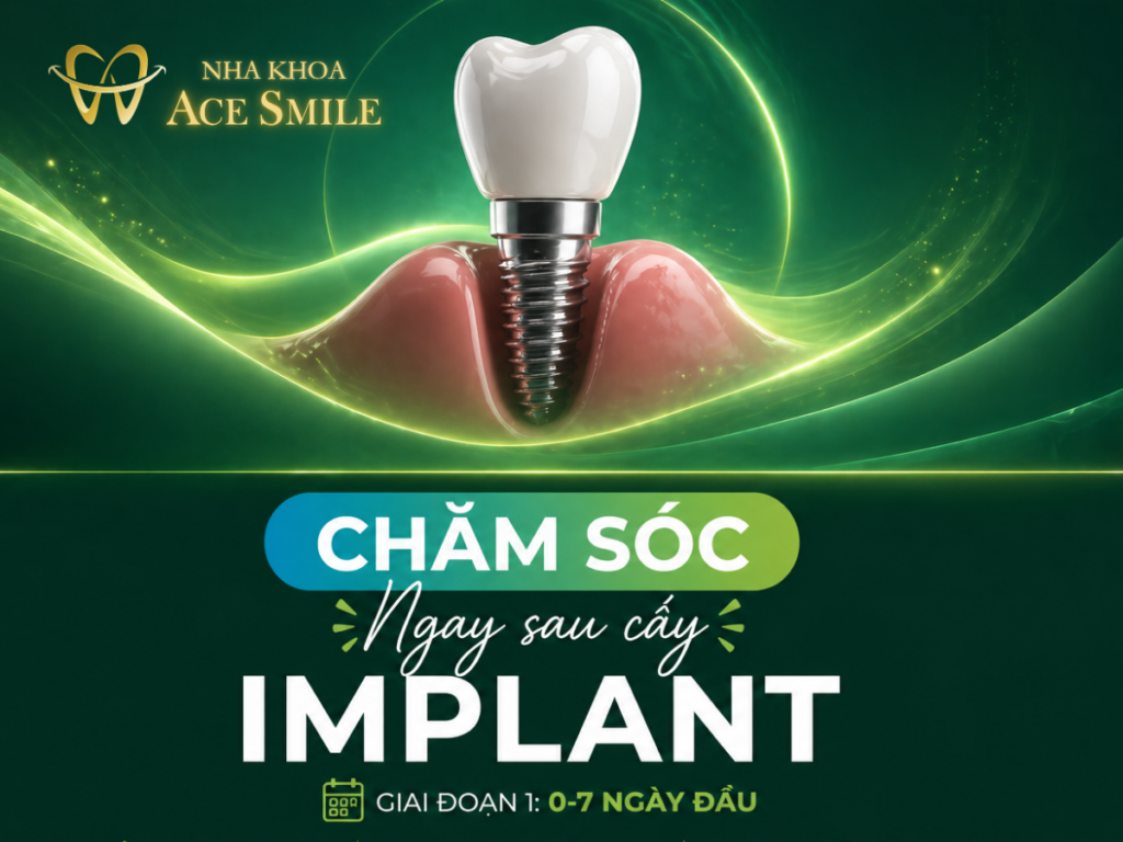 hướng dẫn chăm sóc sau cấy implant bởi nha khoa ace smile, bởi thạc sĩ bác sĩ lầu a minh