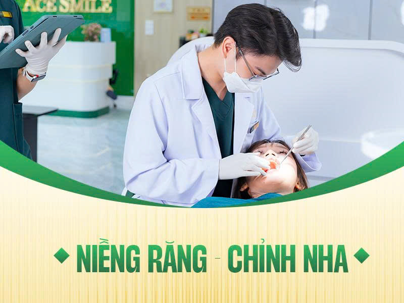 dịch vụ niểng ăng -chỉnh nha tại nha khoa ace smile