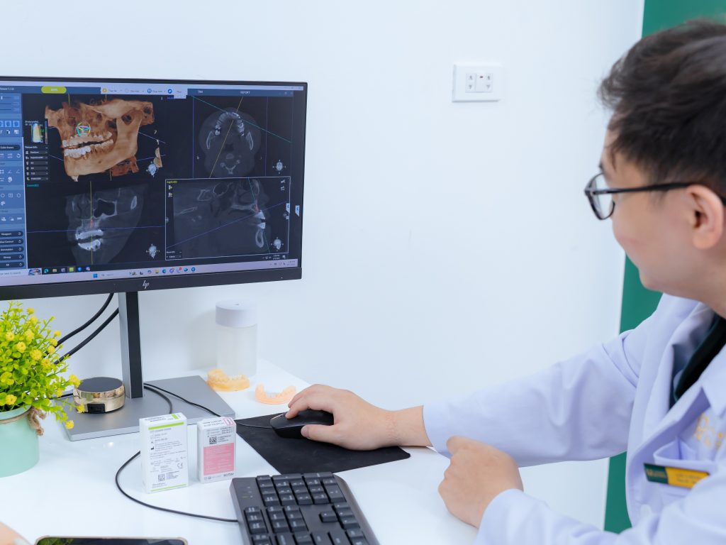 thạc sĩ bác sĩ lầu a minh tư vấn cấy ghép implant