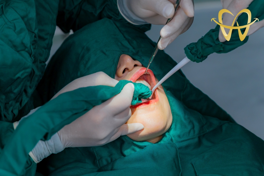 Trồng Implant Răng Cửa - Giải Pháp Hoàn Hảo Lấy Lại Nụ Cười Tự Nhiên