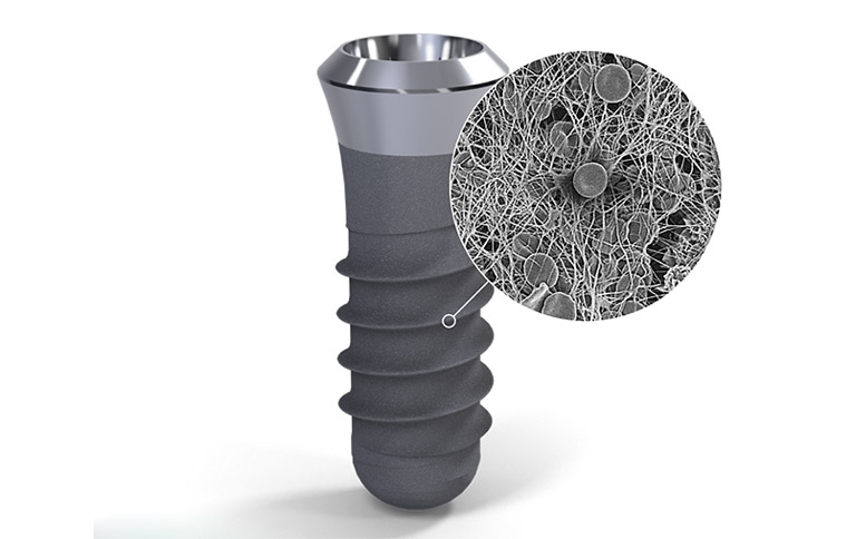 BỀ MẶT ƯA NƯỚC CỦA TRỤ IMPLANT LÀM TĂNG TỐC KHẢ NĂNG TÍCH HỢP XƯƠNG