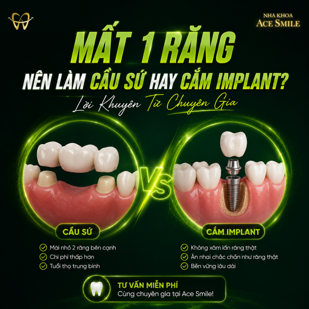 thạc sĩ bác sĩ lầu a minh phân tích nên bọc răng sứ ahy cấy implant khi mất răng