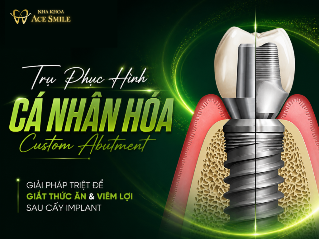 Trụ Phục Hình Cá Nhân Hóa (Custom Abutment): Chỉ Định Lâm Sàng & Lựa Chọn Vật Liệu Chuẩn Y Khoa, bài viết được tham vấn bởi tahcj sĩ bác sĩ Lầu A Minh